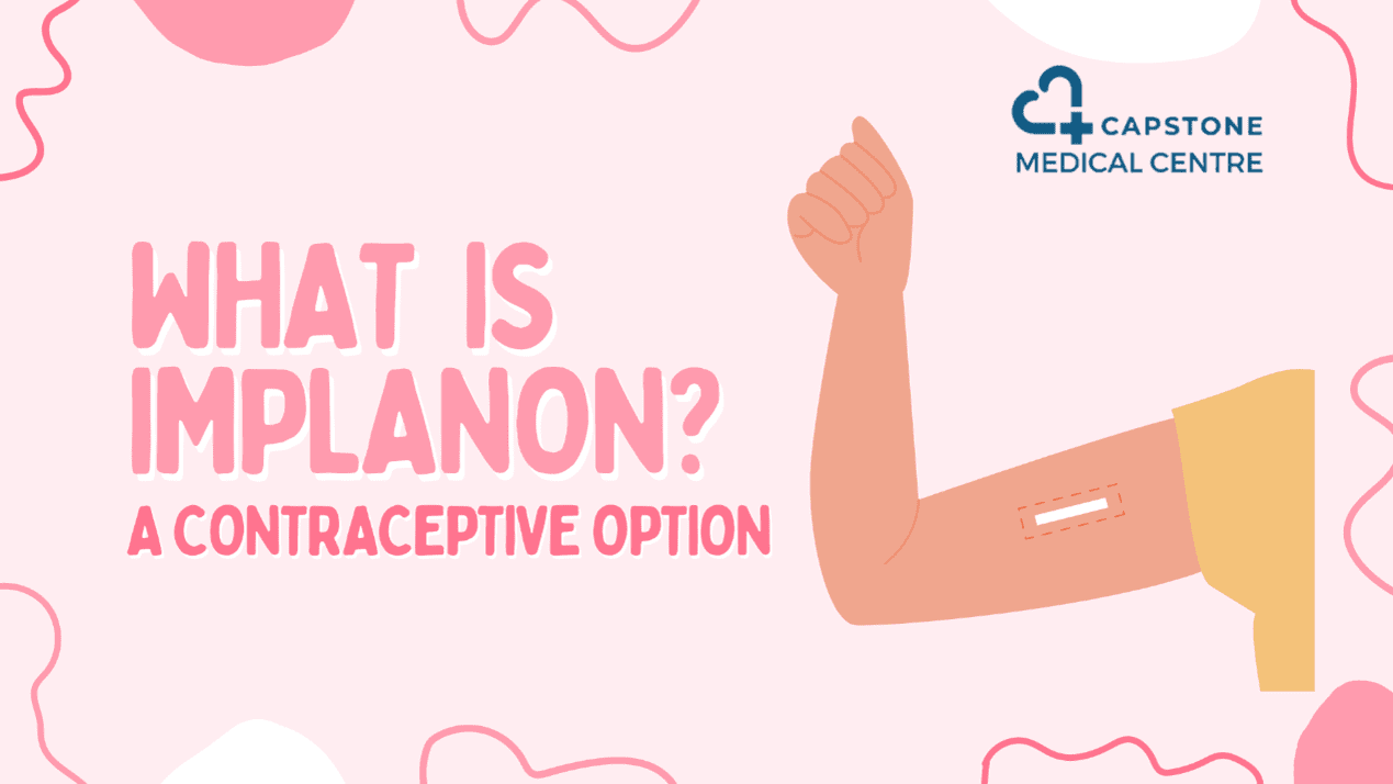 Picture2 - Capstone Medical Centre Southbank What is a Contraceptive Implant?